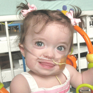 Baby Aubree diagnosed with Jeunes Syndrome